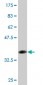 FCN1 Antibody (monoclonal) (M06)